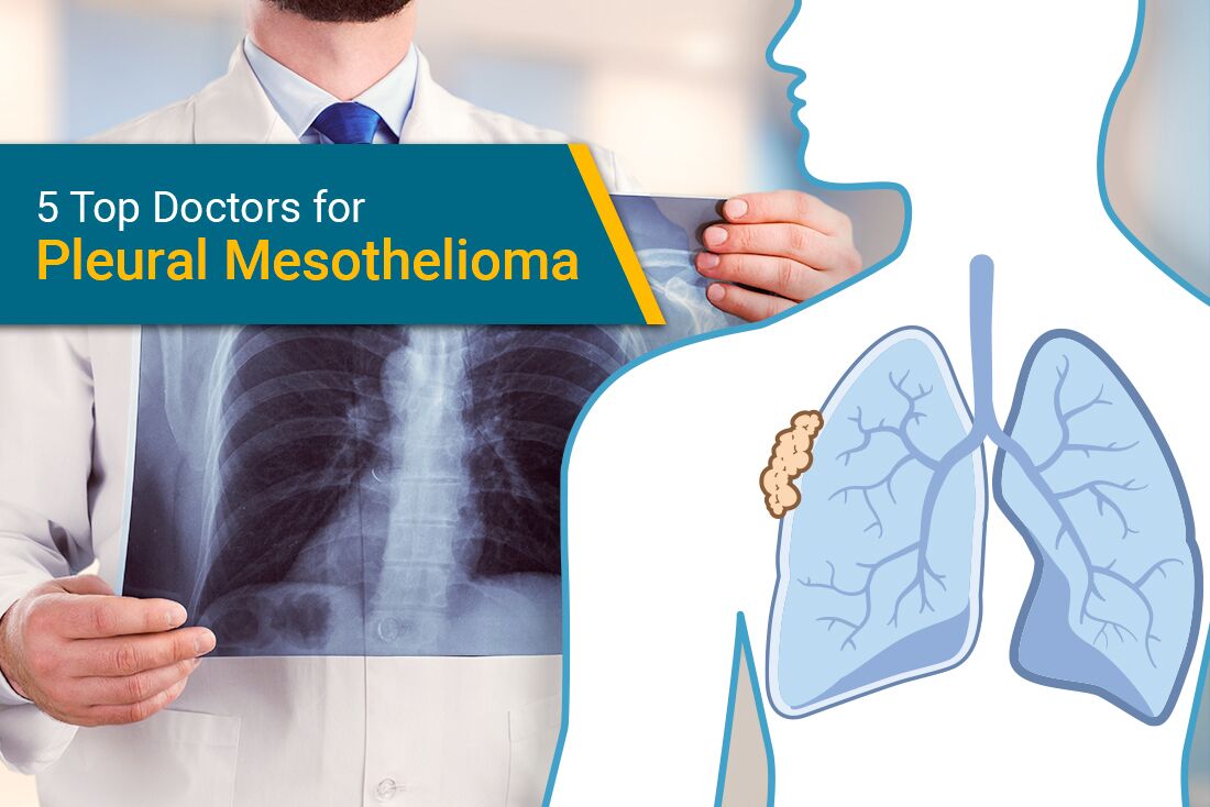 Top pleural mesothelioma doctors in United States