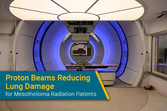 Proton Beams Reducing Lung Damage for Mesothelioma Radiation Patients