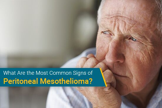 Common Signs of Peritoneal Mesothelioma