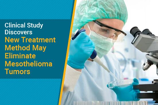 New Treatment Method May Eliminate Mesothelioma Tumors