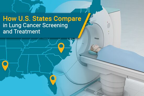lung cancer screening by state