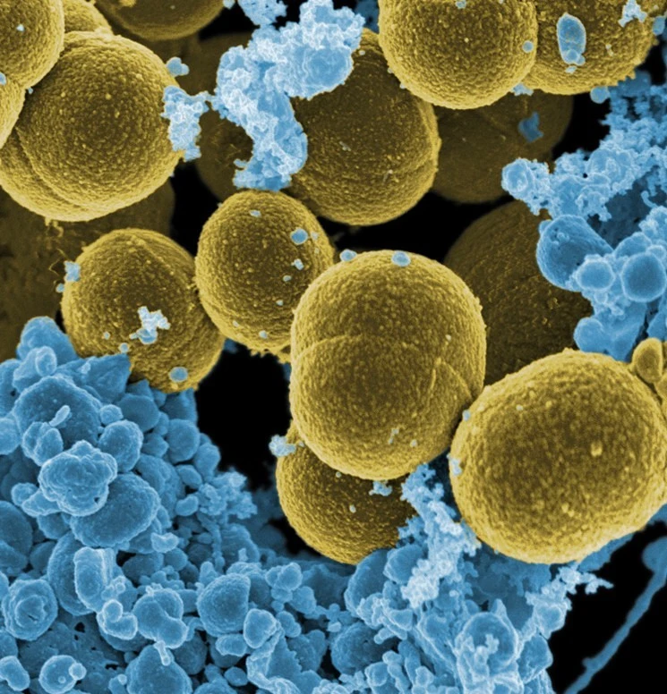 How Researchers Are Using Staph to Fight Mesothelioma