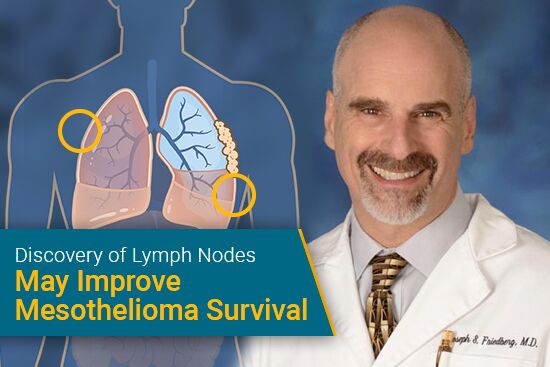 Discovery of Lymph Nodes May Improve Mesothelioma Survival