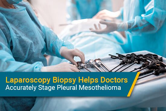 Using Laparoscopy for Pleural Mesothelioma Staging
