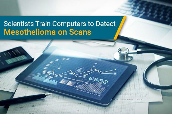 Scientists Train Computers to Detect Mesothelioma on Imaging Scans