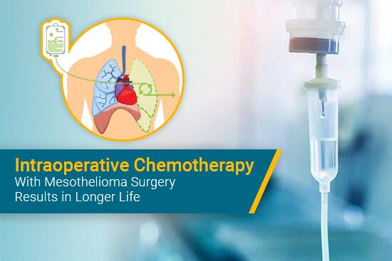 Higher Dose of HITHOC for Mesothelioma Helps Survival