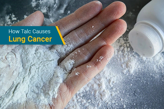how talcum powder can cause lung cancer