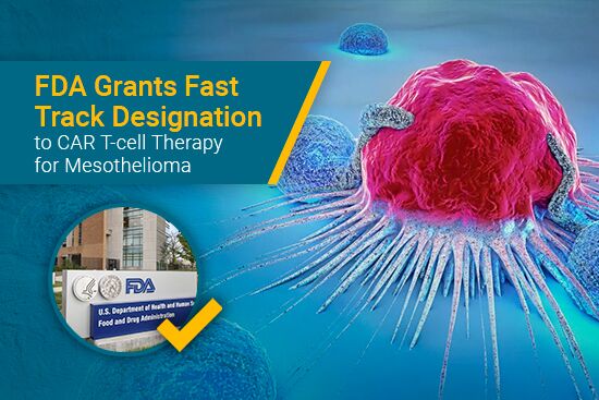 FDA Fast track Designation for CAR T-cell therapy for mesothelioma