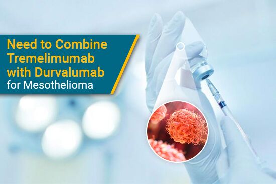 Need to Combine Tremelimumab with Durvalumab for Mesothelioma