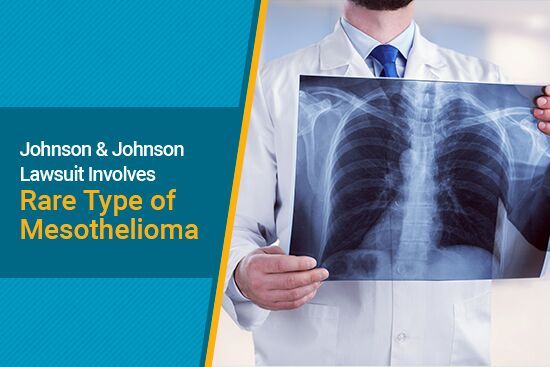 Johnson & Johnson Lawsuit involves Rare Type of Mesothelioma