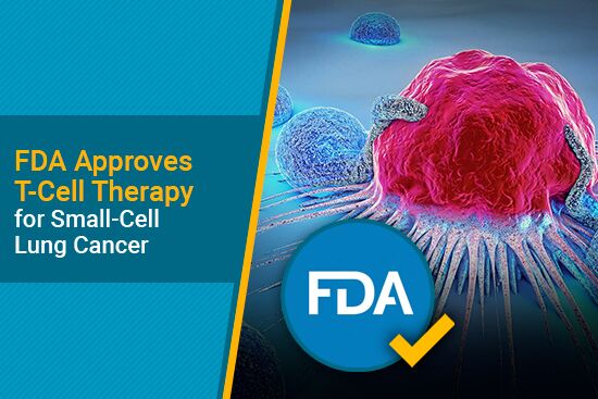 FDA approves T-cell immunotherapy for small-cell lung cancer
