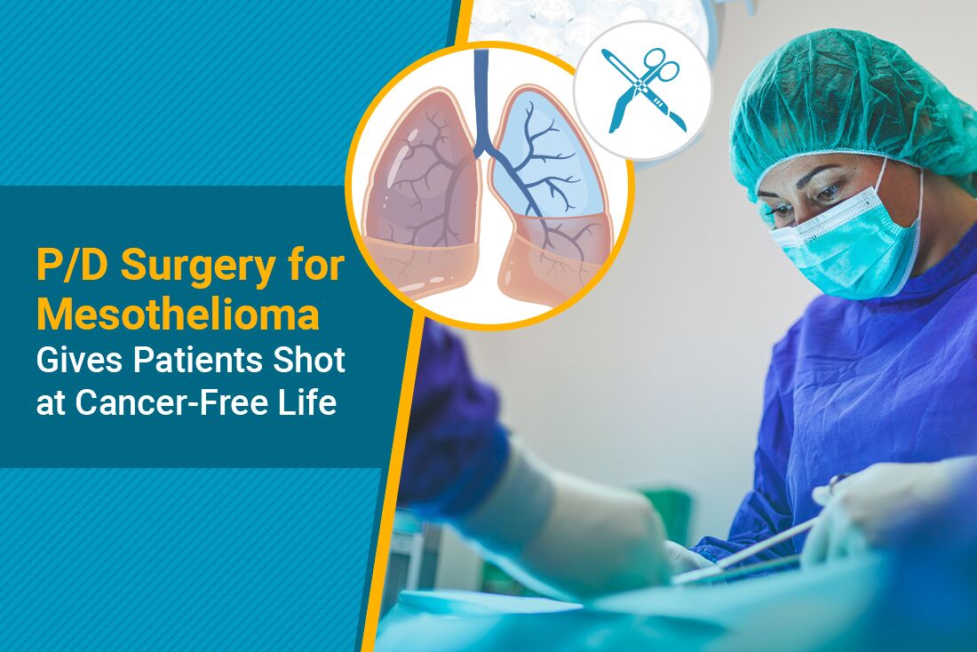 Doctor performing mesothelioma surgery